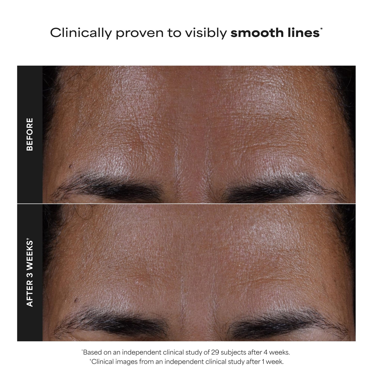 Paula's Choice SKIN PERFECTING 2% BHA Liquid Exfoliant with Salicylic Acid, Facial Polish for Enlarged Pores, Wrinkles & Fine Lines, Suitable for Blackhead-Prone Skin, Fragrance-Free